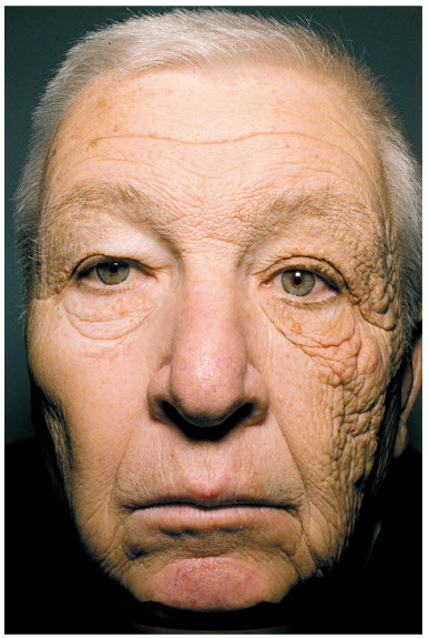 Proof Sun Ages Skin Prematurely