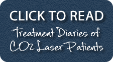 Click HERE to read more about successful CO2 Laser Treatment Patients